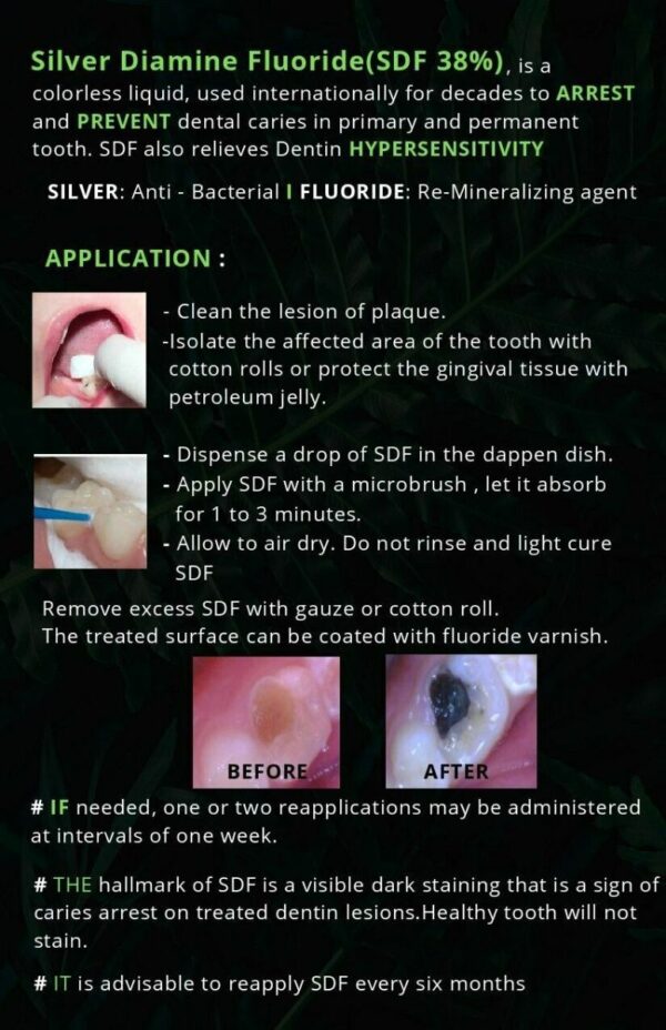 Dengen Caries Arrest Silver Diamine Fluoride 38% - Image 4